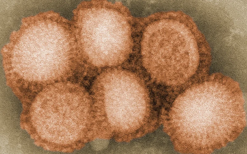 Gripe equina — 🩺 Cuidados y salud